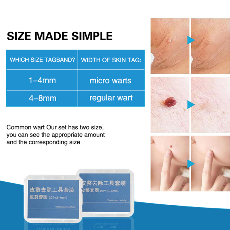 20pcs/Box Flesh Nevus Removal  - Skincare Qv 评论和价格